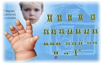 Trastornos Cromos&oacute;micos